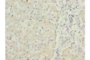 Immunohistochemistry of paraffin-embedded human liver tissue using ABIN7143435 at dilution of 1:100 (ADPGK 抗体  (AA 218-497))