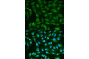 Immunofluorescence (IF) image for anti-Sorbitol Dehydrogenase (SORD) (AA 1-357) antibody (ABIN3022962)