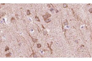 ABIN6273836 at 1/100 staining human brain tissue sections by IHC-P. (5HT1D 抗体  (Internal Region))