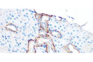 Immunohistochemistry of paraffin-embedded Mouse kidney using YTHDF2 Polyclonal Antibody at dilution of 1:100 (40x lens). (YTHDF2 抗体)