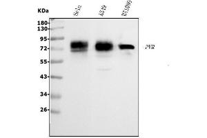 Western blot analysis of Poliovirus Receptor/PVR using anti-Poliovirus Receptor/PVR antibody (ABIN7601069).