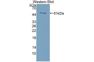 Detection of Recombinant RANkL, Mouse using Polyclonal Antibody to Receptor Activator Of Nuclear Factor Kappa B Ligand (RANkL) (RANKL 抗体  (AA 92-263))