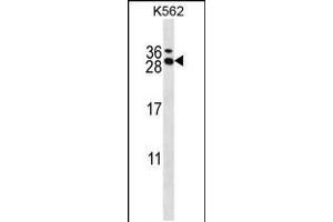 Western blot analysis in K562 cell line lysates (35ug/lane). (RCAN3 抗体  (C-Term))