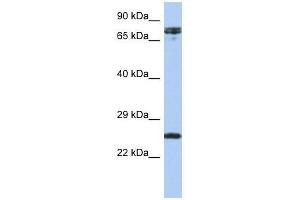 HNF1A antibody used at 0. (HNF1A 抗体  (N-Term))
