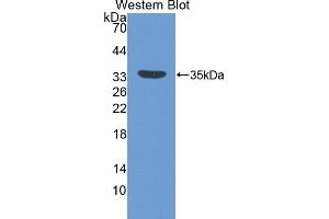 Detection of Recombinant IGFBP5, Mouse using Polyclonal Antibody to Insulin Like Growth Factor Binding Protein 5 (IGFBP5) (IGFBP5 抗体  (AA 25-271))