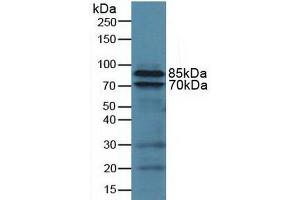 Detection of CD18 in Human U937 Cells using Polyclonal Antibody to Integrin Beta 2 (CD18) (Integrin beta 2 抗体  (AA 451-627))
