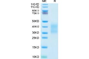 SDS-PAGE (SDS) image for CD79b Molecule, Immunoglobulin-Associated beta (CD79B) (AA 26-158) protein (His tag) (ABIN7274240)