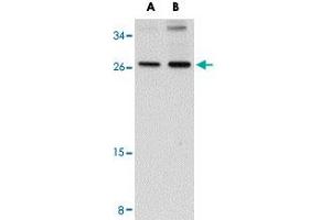 Western blot analysis of SCAMP4 in NIH/3T3 cell lysate with SCAMP4 polyclonal antibody  at (A) 1 and (B) 2 ug/mL . (SCAMP4 抗体  (C-Term))