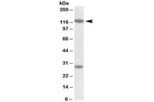 Western blot testing of MOLT4 lysate with UBN1 antibody at 1ug/ml. (Ubinuclein 1 抗体)