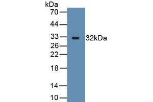 Detection of Recombinant ACTN3, Human using Polyclonal Antibody to Actinin Alpha 3 (ACTN3)