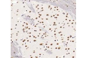 Immunohistochemistry analysis of paraffin-embedded rat brain using,SNRPD2 (ABIN7075634) at dilution of 1: 1600 (SNRPD2 抗体)