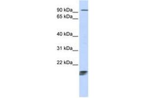 Image no. 1 for anti-Immature Colon Carcinoma Transcript 1 (ICT1) (AA 108-157) antibody (ABIN6743781) (ICT1 抗体  (AA 108-157))