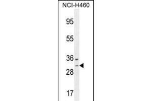 WBSCR27 Antibody (N-term) (ABIN654505 and ABIN2844234) western blot analysis in NCI- cell line lysates (35 μg/lane). (WBSCR27 抗体  (N-Term))