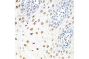 Immunohistochemistry of paraffin-embedded human esophagus using DDX39B antibody at dilution of 1:100 (40x lens).