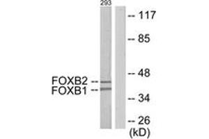 Western blot analysis of extracts from 293 cells, using FOXB1/2 Antibody. (FOXB1/2 抗体  (AA 51-100))