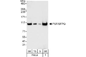 Western Blotting (WB) image for anti-Splicing Factor Proline/glutamine-Ric (SFPQ) (AA 1-50) antibody (ABIN7453760) (SFPQ 抗体  (AA 1-50))