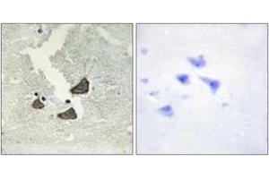 Immunohistochemistry analysis of paraffin-embedded human brain tissue, using EPHB6 Antibody. (EPH Receptor B6 抗体  (AA 861-910))