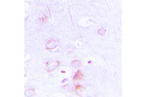 Immunohistochemical analysis of EPB41L2 staining in human brain formalin fixed paraffin embedded tissue section. (EPB41L2 抗体  (Center))