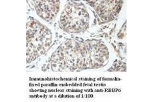 Image no. 1 for anti-Retinoblastoma Binding Protein 6 (RBBP6) antibody (ABIN791194) (RBBP6 抗体)