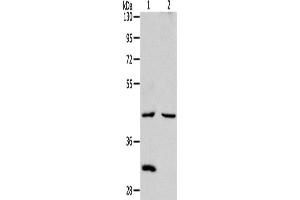 Western Blotting (WB) image for anti-Neutral Cholesterol Ester Hydrolase 1 (NCEH1) antibody (ABIN2422362) (NCEH1 抗体)