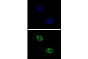 Confocal immunofluorescent analysis of USF1 Antibody (Center) with Hela cell followed by Alexa Fluor 488-conjugated goat anti-rabbit lgG (green).