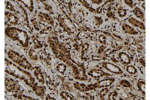 ABIN6277736 at 1/100 staining Human kidney tissue by IHC-P. (GLI1 抗体  (C-Term))