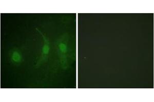 Immunofluorescence analysis of HeLa cells, using IRF3 (Phospho-Ser385) antibody. (IRF3 抗体  (pSer385))