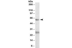 Western blot testing of K562 lysate with EIF2B4 antibody at 0. (EIF2B4 抗体)