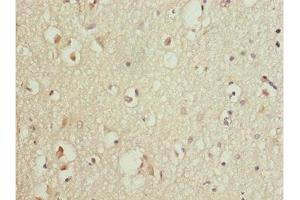 Immunohistochemistry of paraffin-embedded human brain tissue using ABIN7165174 at dilution of 1:100 (TNRC5 抗体  (AA 31-278))