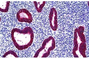 Human Uterus, Endometrium: Formalin-Fixed, Paraffin-Embedded (FFPE) (EpCAM 抗体)