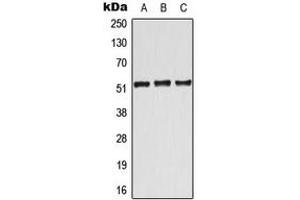 Western blot analysis of ATF7 expression in Jurkat (A), Raw264. (AFT7 抗体  (Center))