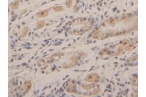 DAB staining on IHC-P; Samples: Human Stomach Tissue (AGR2 抗体  (AA 21-175))