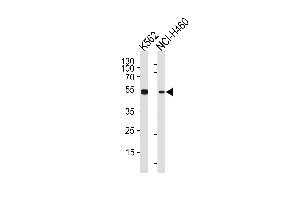 CHEK2 Antibody (N-term) (ABIN1881196 and ABIN2840120) western blot analysis in K562,NCI- cell line lysates (35 μg/lane). (CHEK2 抗体  (N-Term))