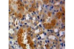 #VALUE! (PLAU 抗体  (AA 21-168))