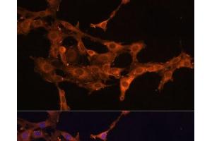 Immunofluorescence analysis of C6 cells using DCN Polyclonal Antibody at dilution of 1:100 (40x lens). (Decorin 抗体)