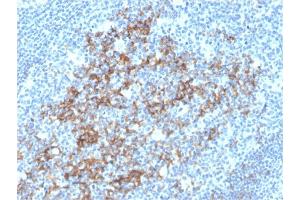 Formalin-fixed, paraffin-embedded human Tonsil stained with CD23-Monospecific Mouse Monoclonal Antibody (FCER2/3592).