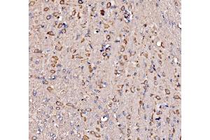 IHC analysis of RPL17 using anti-RPL17 antibody (ABIN7601639). (RPL17 抗体  (AA 40-167))