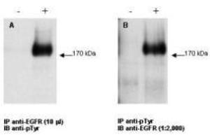 Combined immunoprecipitation and western blot using EGFR antibody. (EGFR 抗体  (C-Term))