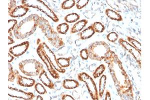 Immunohistochemistry (IHC) image for anti-Tumor Necrosis Factor Receptor Superfamily, Member 9 (TNFRSF9) (AA 19-188) antibody (ABIN6939788)