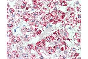 Immunohistochemistry (IHC) image for anti-Solute Carrier Family 7 (Cationic Amino Acid Transporter, Y+ System), Member 2 (SLC7A2) (Internal Region) antibody (ABIN1049350)