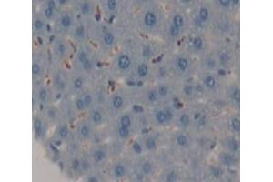 Used in DAB staining on fromalin fixed paraffin- embedded Kidney tissue (AGRN 抗体  (AA 1130-1401))