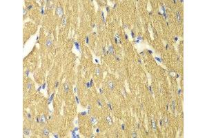 Immunohistochemistry of paraffin-embedded Mouse heart using TPM3 Polyclonal Antibody at dilution of 1:100 (40x lens). (TPM3 抗体)