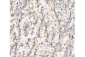 IHC analysis of Integrin Linked ILK using anti-Integrin Linked ILK antibody (ABIN7599411). (ILK 抗体  (AA 1-452))