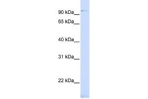 WB Suggested Anti-ZNF598 Antibody Titration:  0. (ZNF598 抗体  (Middle Region))
