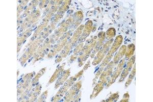 Immunohistochemistry of paraffin-embedded Mouse stomach using NDUFB10 Polyclonal Antibody at dilution of 1:100 (40x lens). (NDUFB10 抗体)