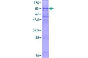 FLVCR Protein (AA 1-555) (GST tag)