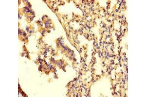 Immunohistochemistry of paraffin-embedded human lung tissue using ABIN7161472 at dilution of 1:100 (Neurotrypsin 抗体  (AA 631-874))
