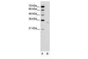 Image no. 2 for anti-Dicarbonyl/L-Xylulose Reductase (DCXR) (AA 151-200) antibody (ABIN6736636) (DCXR 抗体  (AA 151-200))