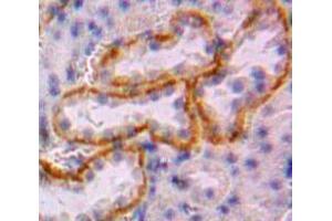 IHC-P analysis of Kidney tissue, with DAB staining. (CUBN 抗体  (AA 3157-3274))