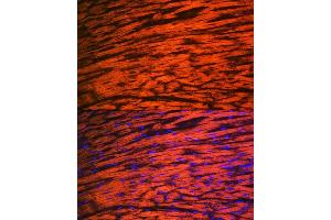 Immunofluorescence analysis of rat heart using MYL2 Rabbit mAb (ABIN7268761) at dilution of 1:100 (40x lens). (MYL2 抗体)